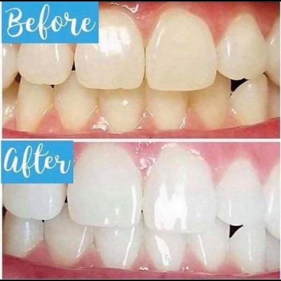 Whitening Toothpaste - Picture 5 of 6